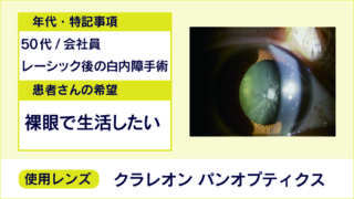 【白内障手術 症例3】50代/多焦点レンズ：クラレオン パンオプティクス